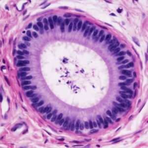 Ductus Epididymidis