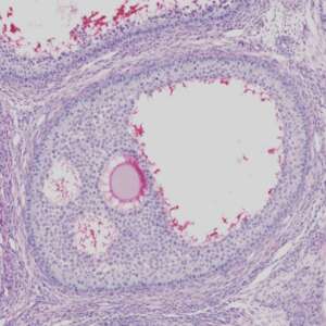Ovary