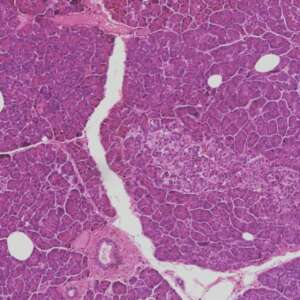 Pancreas