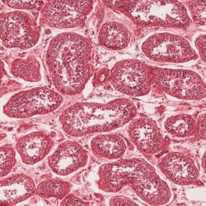 Spermatogonia