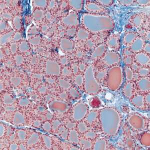 Thyroid gland